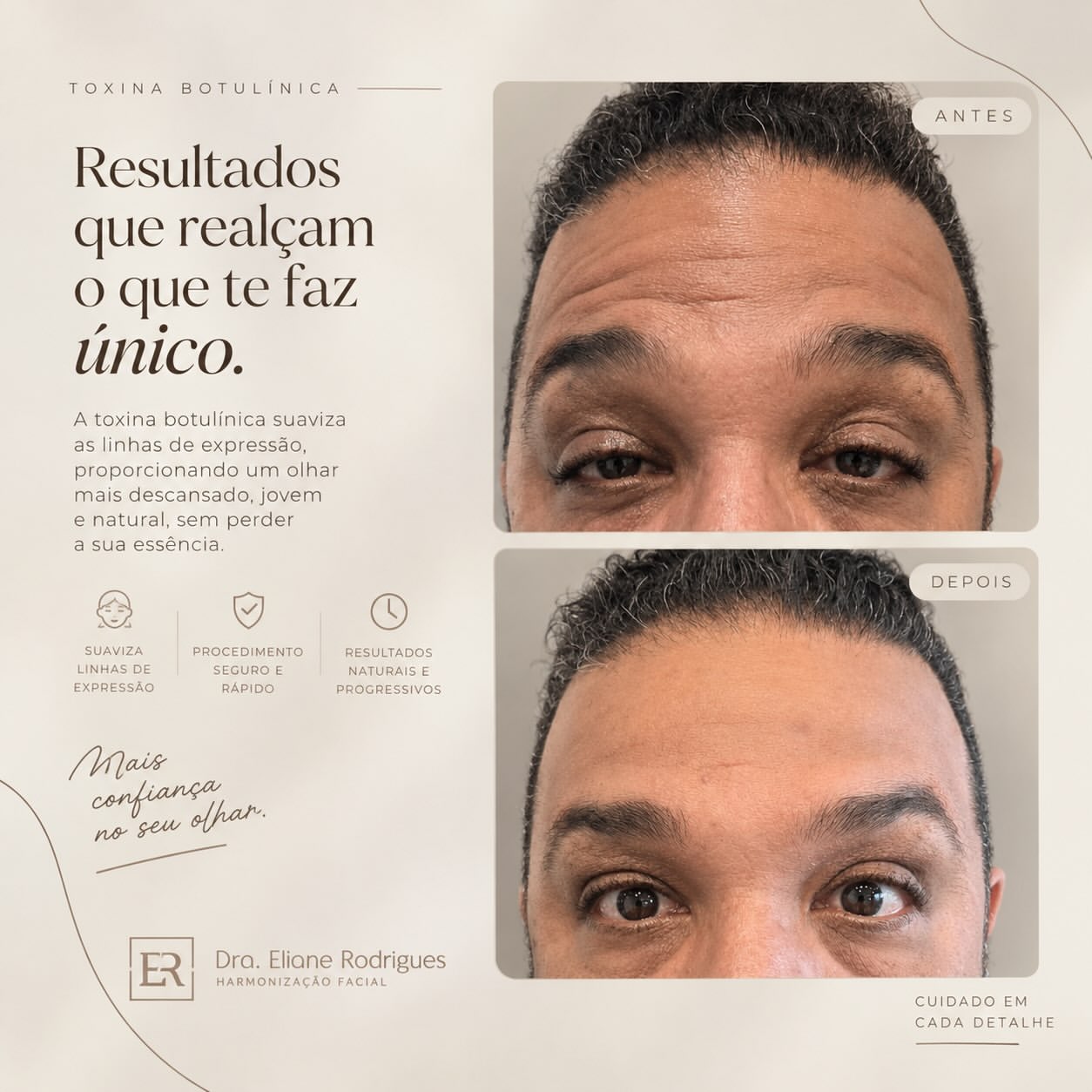 Botox com a Dra. Eliane — imagem 2